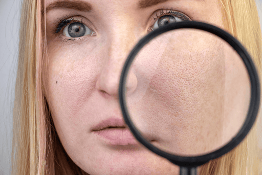 Can You Shrink Large Pores or Is That Just a Skincare Myth?