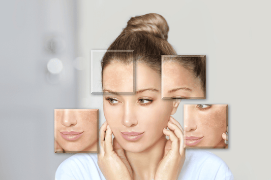 How to Identify Your Skin Type:  Simple Tests and Skincare Tips for Every Type