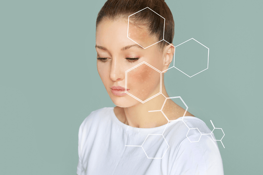 New Skincare Product Causing Breakouts? How to Tell If It’s Purging or a Reaction