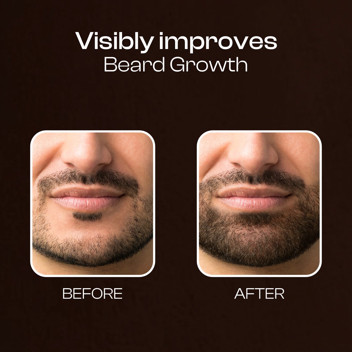 Beard Growth Serum - 30 ML