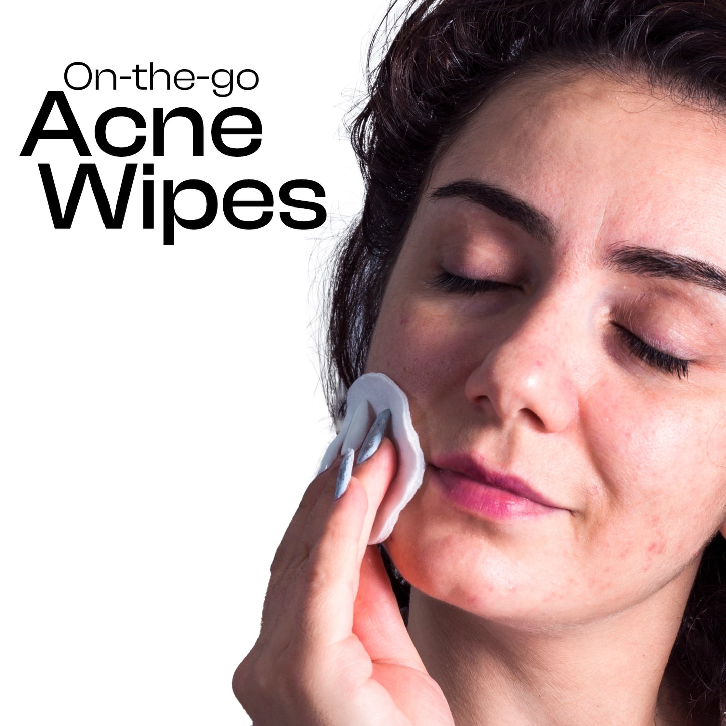 Lelys Acne Wipe Out - 60 pads