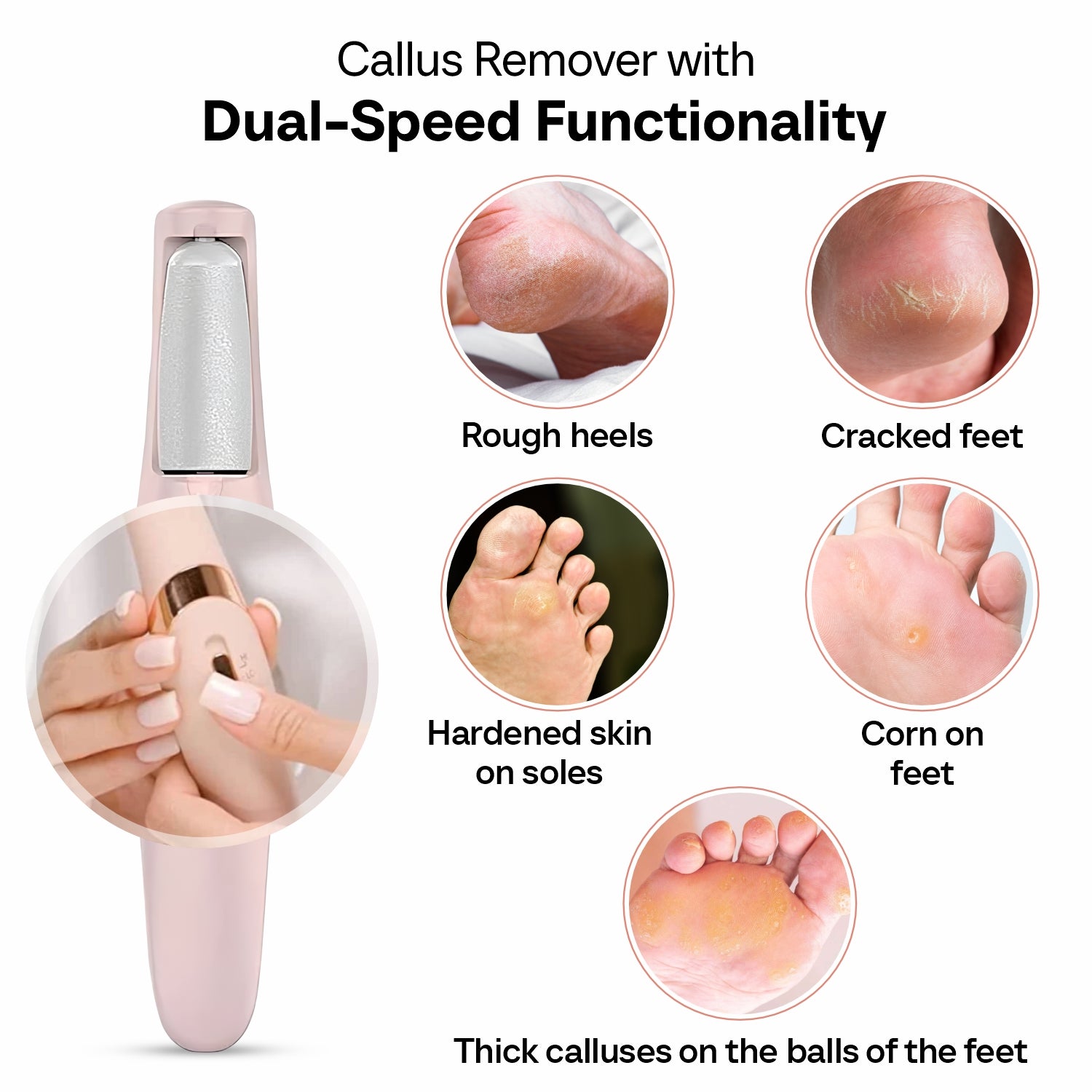 Buy Electric Callus Remover For Feet Online at Best Price in India - Lely's